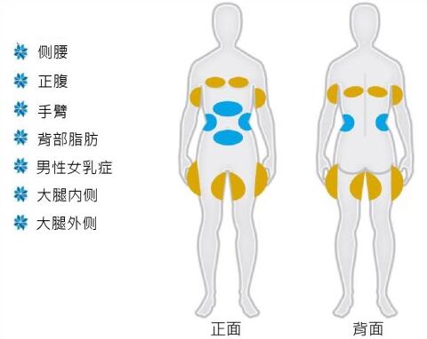 西安冷冻溶脂|酷塑非侵入式体雕 改善臃肿赘肉