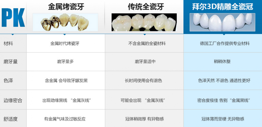 淘整形 北京烤瓷牙 北京全瓷美容冠  适应人群: 牙体形态异常,如锥形