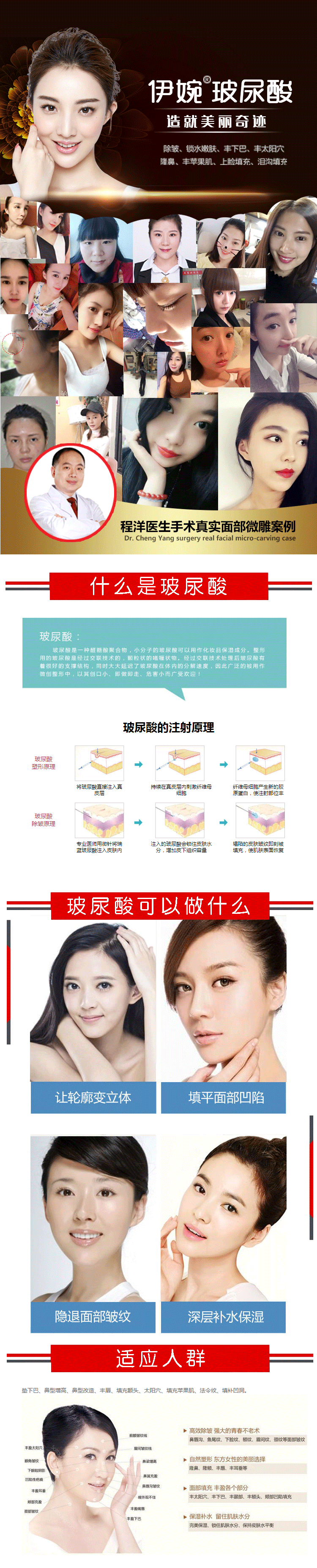 徐州伊婉玻尿酸 1ml 不变美何来心动 正品原装玻尿酸 给你更完美容颜