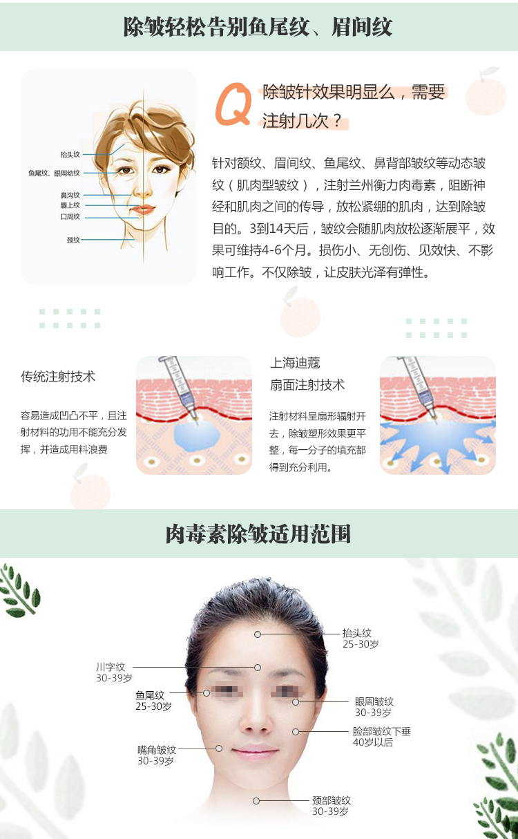 注射微整|①国产除皱单部位②抬头纹/眉间纹/鱼尾纹